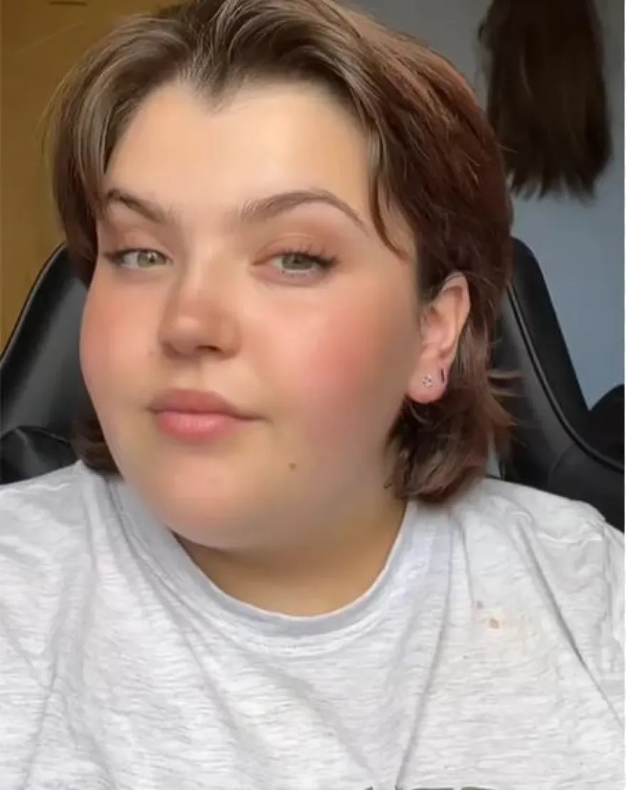 Μόργκαν Ριμπέιρο Τούρκος Χειρουργός Βάρος Δακτύλιος