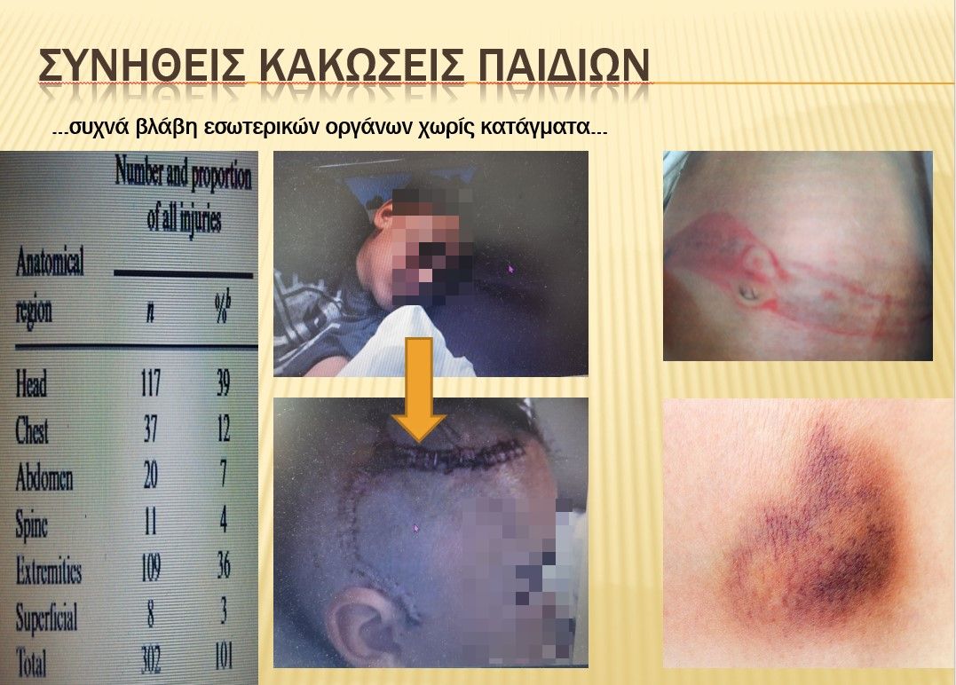 παιδιά τροχαία