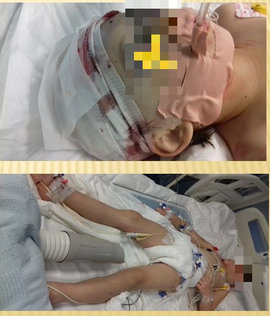 παιδιά νοσοκομείο τροχαία