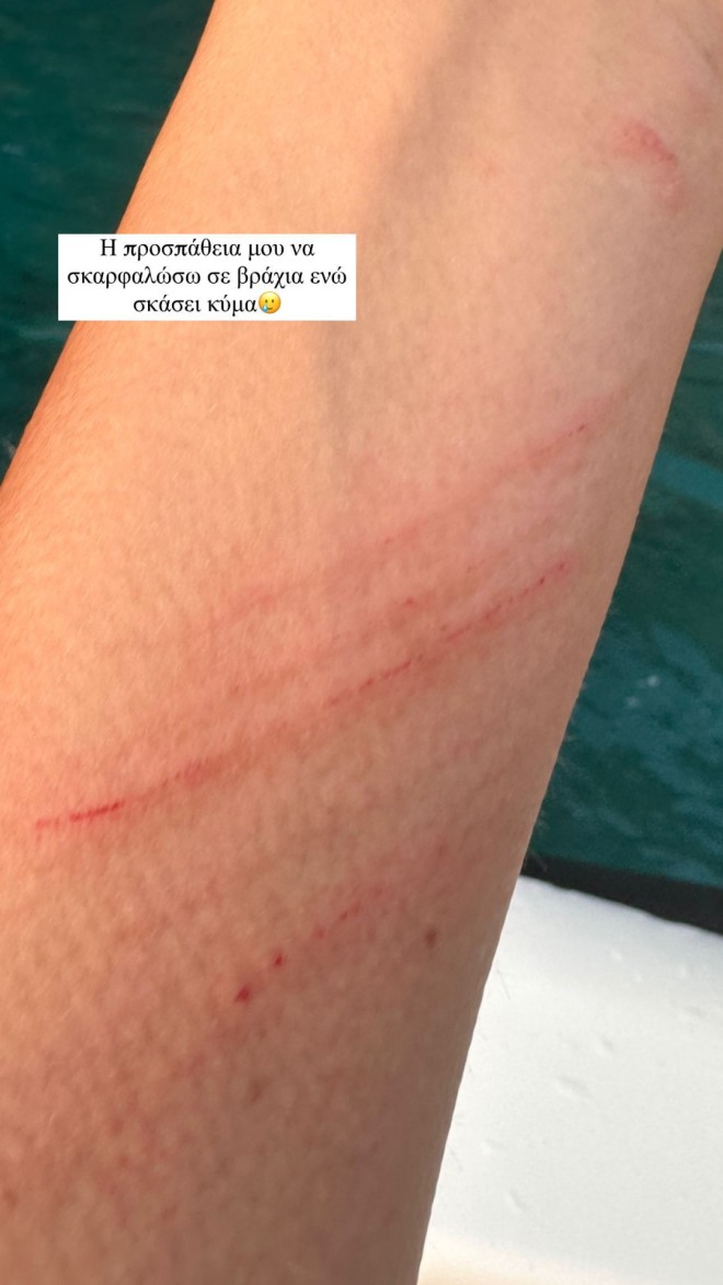  Χτύπησε σε βράχια