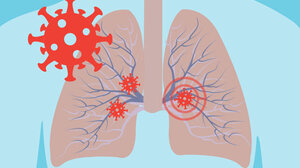 Γιαμαρέλλος για την ελληνική συμμετοχή στην έρευνα με το φάρμακο που προλαμβάνει την πνευμονία
