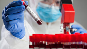 Στα 1.360 τα νέα κρούσματα κορωνοϊού στην Κρήτη την Κυριακή!