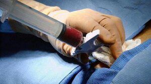 Πώς θα γίνω δότης μυελού των οστών;