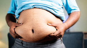 Λίπος στην κοιλιά: Οι κίνδυνοι για τους οποίους προειδοποιούν οι γιατροί