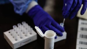 ΠΑΣΙΔΙΚ: «Πώς μπορούν να διατίθενται τα PCR σε τιμές κάτω του κόστους;»