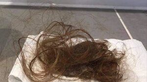 «Αυτό αντίκρισα όταν πήγα να χτενιστώ» - Μαρτυρίες ανθρώπων με long Covid