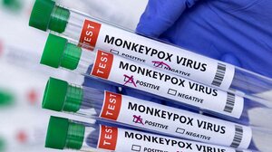 Ευλογιά των πιθήκων: «Οι χειρότεροι πόνοι της ζωής μου», λέει ασθενής 