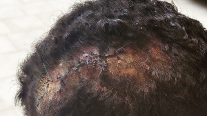 Τη Δευτέρα η δίκη του εργολάβου που χτύπησε βάναυσα τον εργάτη