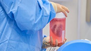 Δύο ακόμη γενετικά τροποποιημένες καρδιές χοίρων μεταμοσχεύθηκαν επιτυχώς σε ανθρώπους