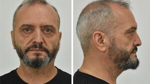 Κολωνός: Η ώρα της απολογίας του 53χρονου που εξέδιδε την ανήλικη