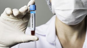 Κορωνοϊός: 65 θάνατοι σε μία εβδομάδα - 75 οι διασωληνωμένοι ασθενείς