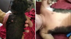 Μωρό με σπάνια πάθηση γεννήθηκε στην Ινδία