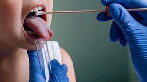 Στρεπτόκοκκος: Τι πρέπει να προσέχουν οι γονείς για παιδιά ως 12 ετών