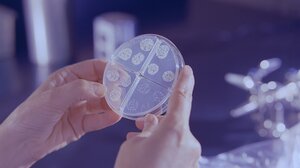 Φυματίωση: Πάνω από 10.000 επιβεβαιωμένα κρούσματα στις ΗΠΑ το 2024