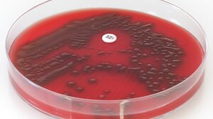 Ματίνα Παγώνη: «Δεν κάνει οι μητέρες να κάνουν μόνες τους το strep test»