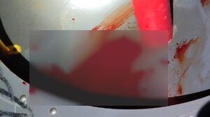 Σοκαριστικό ατύχημα σε παιδική χαρά - 14χρονη τραυματίστηκε σοβαρά στο κεφάλι