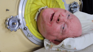 Πολ Αλεξάντερ: Ο άνθρωπος που έζησε 72 χρόνια σε σιδερένιο πνεύμονα