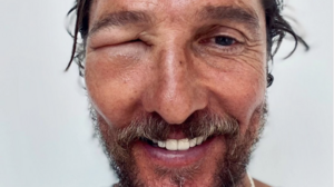 Με πρησμένο μάτι εμφανίστηκε ο Μάθιου Μακόναχι 