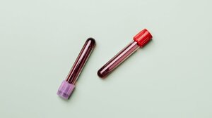 CarD-Clone: Έρευνα για τις γενετικές μεταλλάξεις στο αίμα και τα καρδιαγγειακά νοσήματα