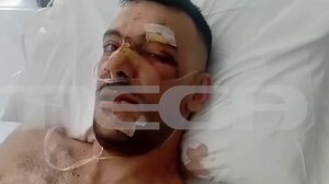 Από θαύμα ζει ο 35χρονος μετά τις 18 μαχαιριές - "Έχει τρύπες σε πνεύμονα, διάφραγμα και του κόπηκαν οι μύες"