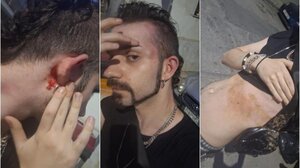 Ομοφοβική επίθεση σε βάρος νεαρού στην Ανθούπολη - Τον κλωτσούσαν και τον έβριζαν στη μέση του δρόμου