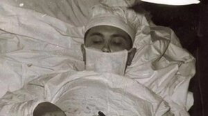 Ο γιατρός που χειρούργησε τον εαυτό του: Η αληθινή ιστορία πίσω από τη φωτογραφία που συγκλονίζει