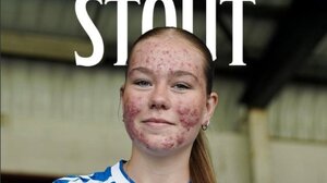 Διαδικτυακό bullying σε 16χρονη ποδοσφαιρίστρια για την εμφάνισή της