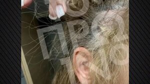 43χρονη καταγγέλλει ότι έπεσε θύμα ξυλοδαρμού στη μέση του δρόμου από γιατρό