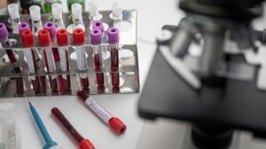 Νέα εξέταση αίματος ανιχνεύει τη χρόνια κόπωση