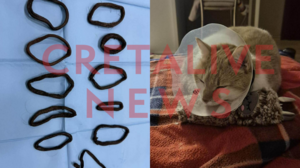 Ηράκλειο: αφαίρεσαν από την κοιλιά της 11 κοτσιδάκια για τα μαλλιά