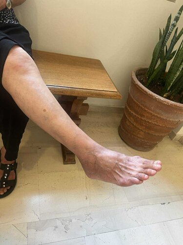 γυναικα-τραυματισμός