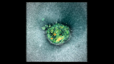 Επιστήμονες κατέγραψαν για πρώτη φορά σε βίντεο την εμφύτευση ανθρώπινου εμβρύου στη μήτρα