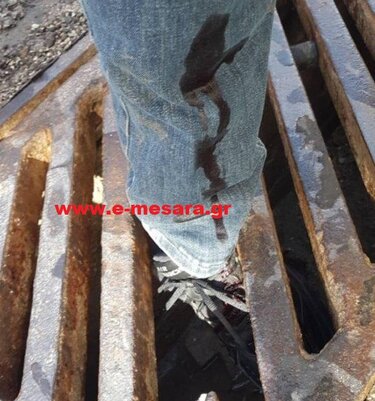 τραυματισμός φρεάτιο