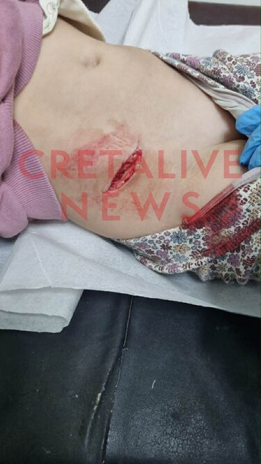 Οδός Εφόδου, Ατύχημα, Παιδάκι