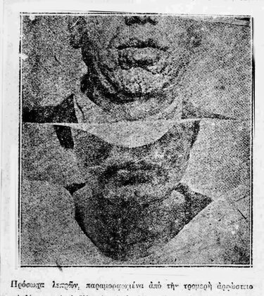 Σπιναλόνγκα, Λεπροί, Ρεπορτάζ 1929