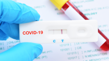 Iταλία: Στα 149.512 τα κρούσματα κορωνοϊού, με 248 θανάτους