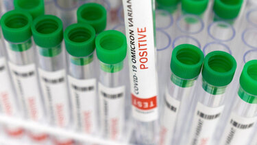 Μετάλλαξη «Όμικρον»: Τι λένε οι ερευνητές για την προέλευσή της