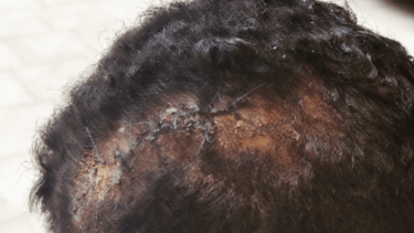 Ενώπιον της δικαιοσύνης ο εργολάβος που χτύπησε τον εργάτη 