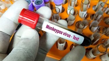 Βραζιλία: Πρώτος θάνατος από την ευλογιά των πιθήκων