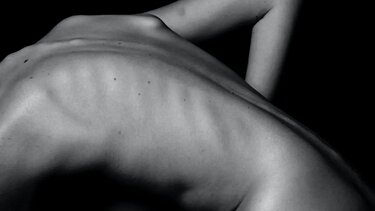 Η παρατεταμένη κακή στάση σώματος που βλάπτει τη σπονδυλική στήλη