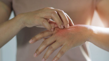 Αλλεργικό σοκ: Πότε μια τροφική αλλεργία μπορεί να σκοτώσει