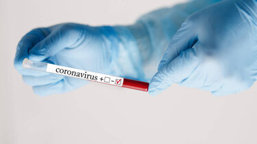 Δεκάδες θετικά τεστ κορωνοϊού σε εκατοντάδες ελέγχους στην Κρήτη