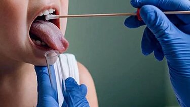 Στρεπτόκοκκος: Τι πρέπει να προσέχουν οι γονείς για παιδιά ως 12 ετών