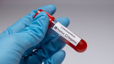 ΠΟΥ: Έχουμε τα εργαλεία για να τερματίσουμε φέτος την πανδημία του κορωνοϊού