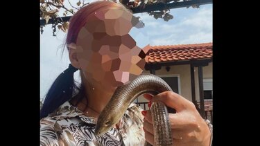 Σταθερή βελτίωση παρουσιάζει η 39χρονη ερπετολόγος μετά το δάγκωμα οχιάς
