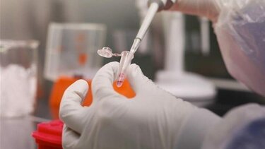 Τι είναι ο παρβοϊός, πώς μεταδίδεται, ποια τα συμπτώματα