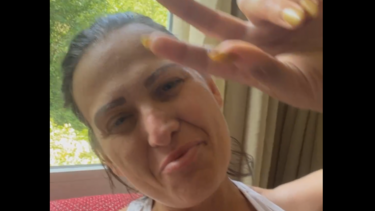 Συγκλονίζει η εθελόντρια που τη δάγκωσε οχιά: "Ήμουν κλινικά νεκρή"