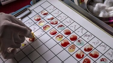 Πάρκινσον: Εξέταση αίματος μπορεί να προβλέψει τη νόσο 7 χρόνια πριν τα συμπτώματα