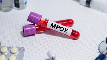 Mpox: Το νέο στέλεχος αλλάζει γρήγορα 