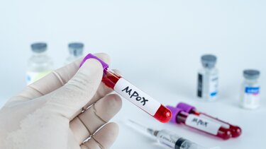 Mpox: Πρώτο κρούσμα στις Φιλιππίνες φέτος